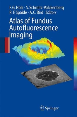 Atlas of Fundus Autofluorescence Imaging book