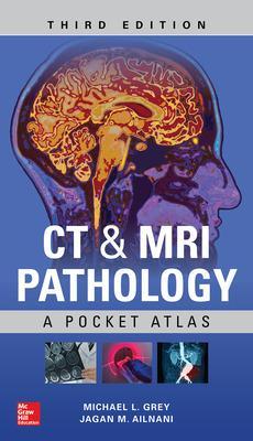 CT & MRI Pathology: A Pocket Atlas, Third Edition book