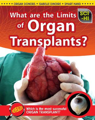 What Are the Limits of Organ Transplantation? by Anna Claybourne