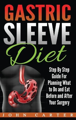 Gastric Sleeve Diet: Step By Step Guide For Planning What to Do and Eat Before and After Your Surgery book