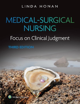 Medical-Surgical Nursing: Focus on Clinical Judgment book