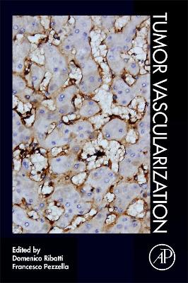 Tumor Vascularization book