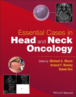 Essential Cases in Head and Neck Oncology book