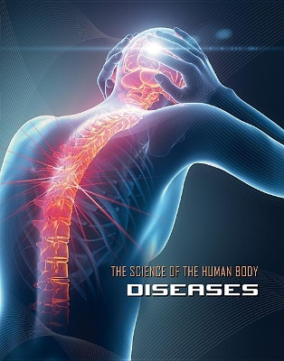 Science of the Human Body: Diseases book