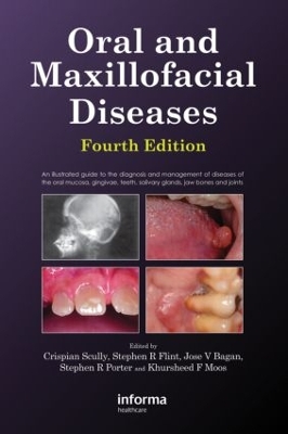 Oral and Maxillofacial Diseases book