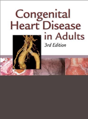Congenital Heart Disease in Adults book