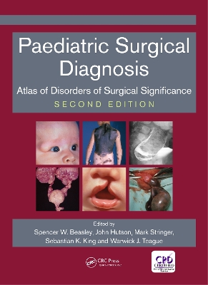 Paediatric Surgical Diagnosis: Atlas of Disorders of Surgical Significance, Second Edition by Spencer Beasley