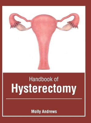 Handbook of Hysterectomy book