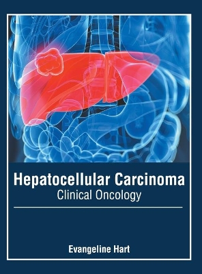 Hepatocellular Carcinoma: Clinical Oncology book