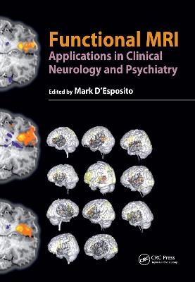 Functional MRI book