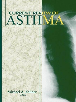 Current Review of Asthma book