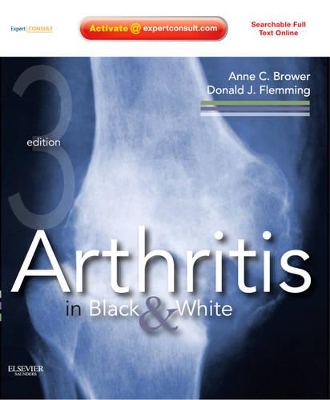 Arthritis in Black and White book
