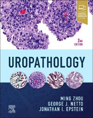 Uropathology book
