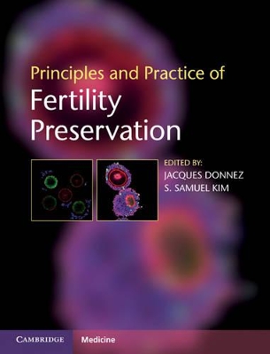 Principles and Practice of Fertility Preservation by Jacques Donnez