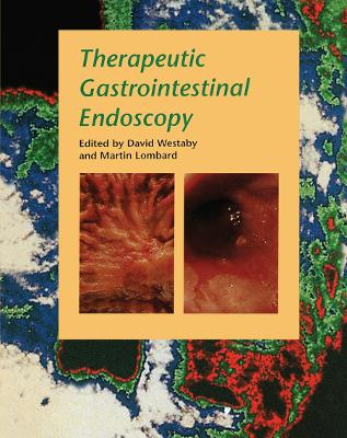 Therapeutic Gastrointestinal Endoscopy by David Westaby