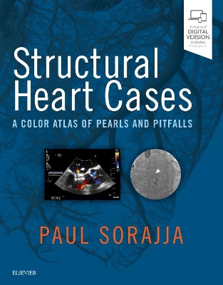 Structural Heart Cases book