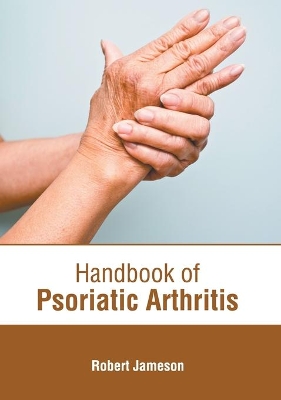 Handbook of Psoriatic Arthritis book