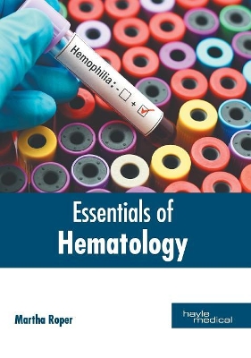 Essentials of Hematology book