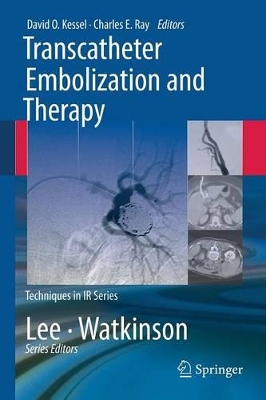 Transcatheter Embolization and Therapy by David Kessel