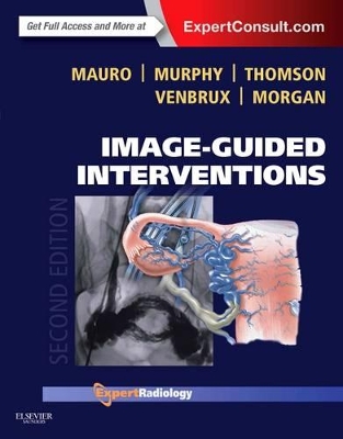 Image-Guided Interventions book