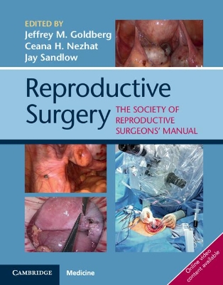 Reproductive Surgery: The Society of Reproductive Surgeons' Manual book