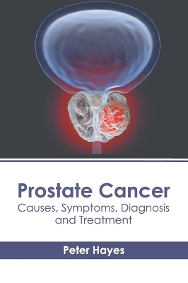 Prostate Cancer: Causes, Symptoms, Diagnosis and Treatment book