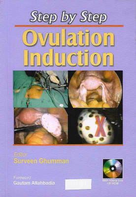 Ovulation Induction book