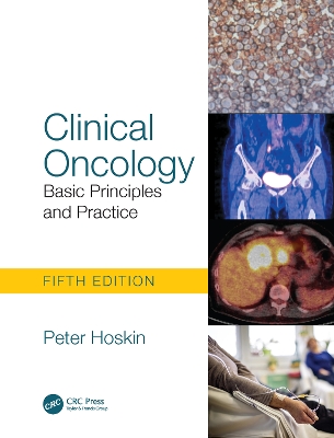 Clinical Oncology: Basic Principles and Practice by Peter Hoskin
