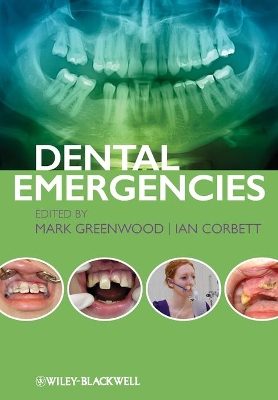 Dental Emergencies by Mark Greenwood
