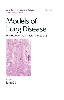 Models of Lung Disease by Joan Gil