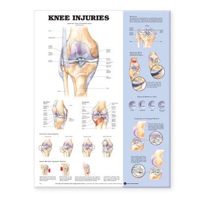 Knee Injuries Anatomical Chart by Anatomical Chart Company