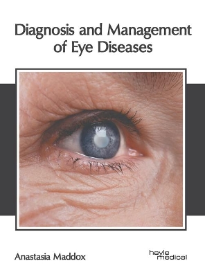 Diagnosis and Management of Eye Diseases book