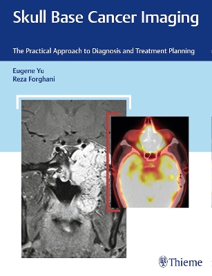 Skull Base Cancer Imaging book