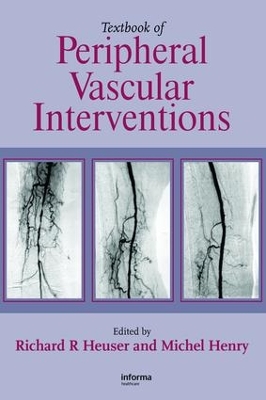 Textbook of Peripheral Vascular Interventions by Richard R. Heuser