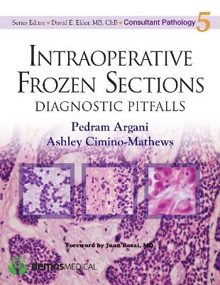 Intraoperative Frozen Sections book