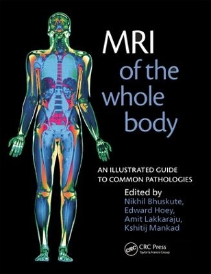 MRI of the Whole Body: An Illustrated Guide for Common Pathologies by Nikhil Bhuskute