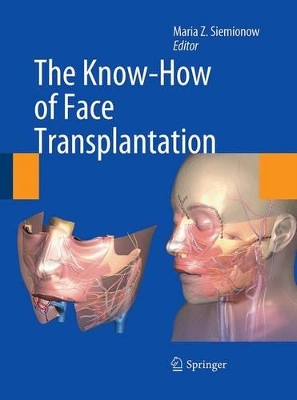 Know-How of Face Transplantation book