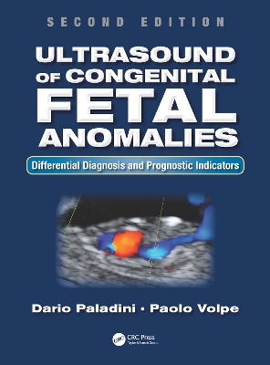 Ultrasound of Congenital Fetal Anomalies: Differential Diagnosis and Prognostic Indicators, Second Edition by Dario Paladini