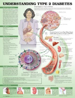 Understanding Type 2 Diabetes Anatomical Chart book