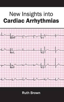 New Insights Into Cardiac Arrhythmias by Ruth Brown
