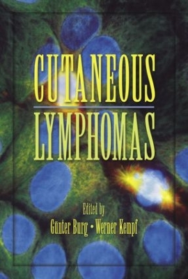 Cutaneous Lymphomas book