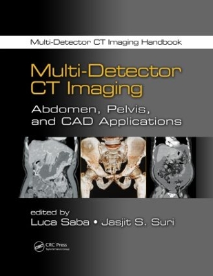 Multi-Detector CT Imaging by Luca Saba