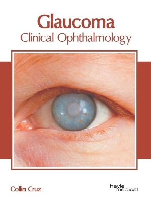 Glaucoma: Clinical Ophthalmology book