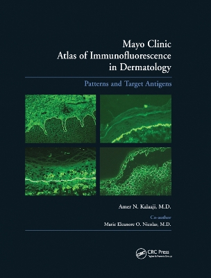 Mayo Clinic Atlas of Immunofluorescence in Dermatology: Patterns and Target Antigens book