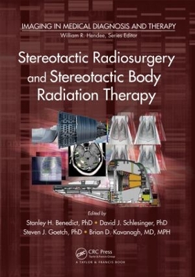 Stereotactic Radiosurgery and Stereotactic Body Radiation Therapy by Stanley H. Benedict