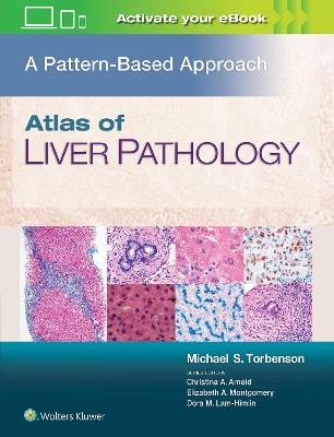 Atlas of the Liver and Pancreas Pathology book