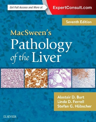 MacSween's Pathology of the Liver book