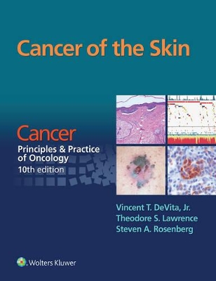 Cancer of the Skin: Cancer: Principles & Practice of Oncology, 10th Edition book