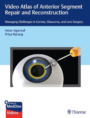 Video Atlas of Anterior Segment Repair and Reconstruction: Managing Challenges in Cornea, Glaucoma, and Lens Surgery book