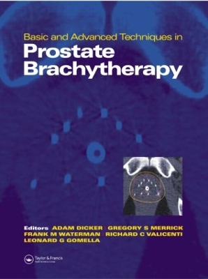 Basic and Advanced Techniques in Prostate Brachytherapy book